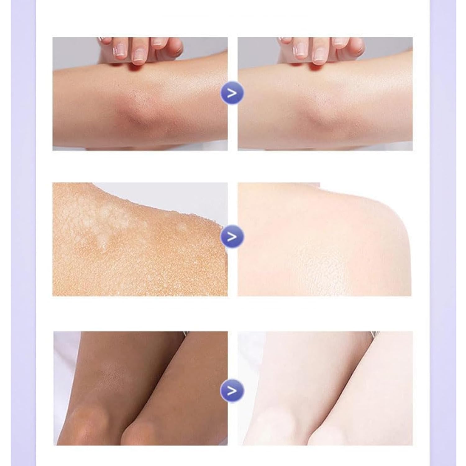 Omenfee Cold White Skin All Over ( BUY 1 GET 1 FREE )