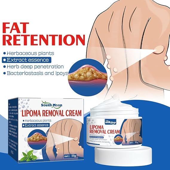 South Moon Lipoma Removal Cream ( Buy 1 Get 1 Free )