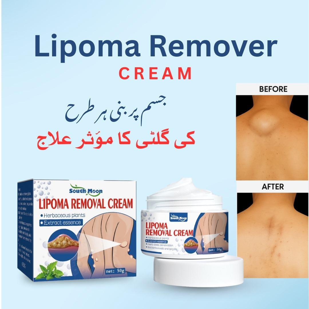 South Moon Lipoma Removal Cream ( Buy 1 Get 1 Free )