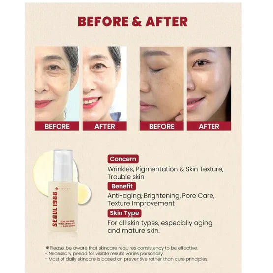 SEOUL 1988 Eye Cream – Retinal Liposome 4% + Fermented Bean ( Buy 1 Get 1 Free )