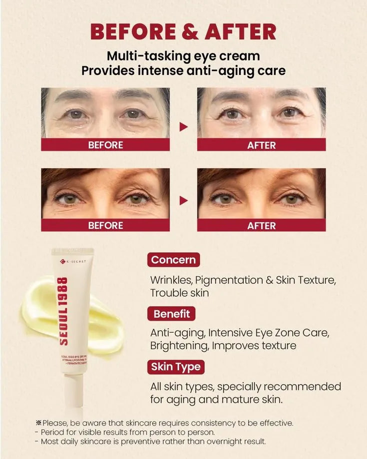 SEOUL 1988 Eye Cream – Retinal Liposome 4% + Fermented Bean ( Buy 1 Get 1 Free )