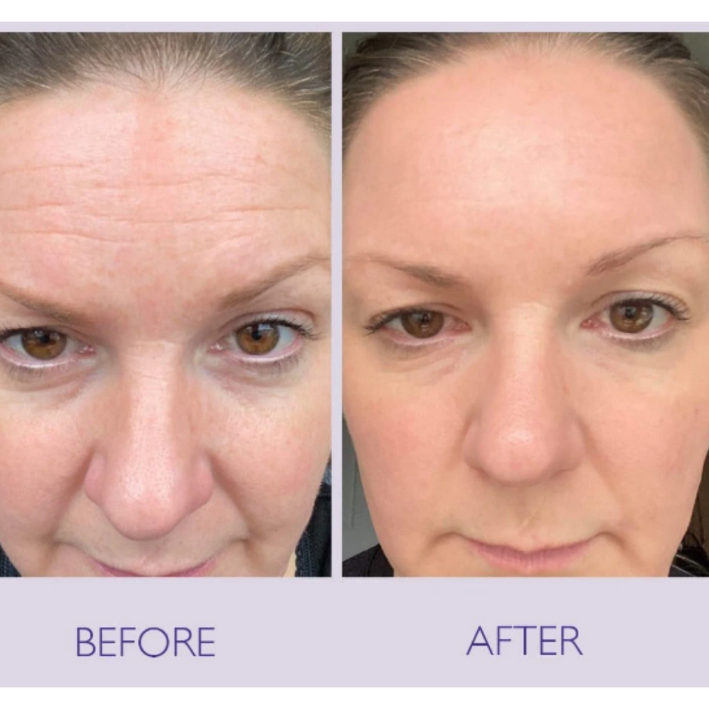 Seoul 1988 Eye Cream +
Celimax Retinal Shot Booster