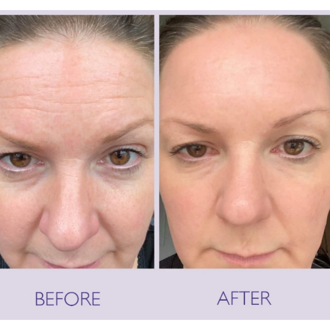 Seoul 1988 Eye Cream +
Celimax Retinal Shot Booster