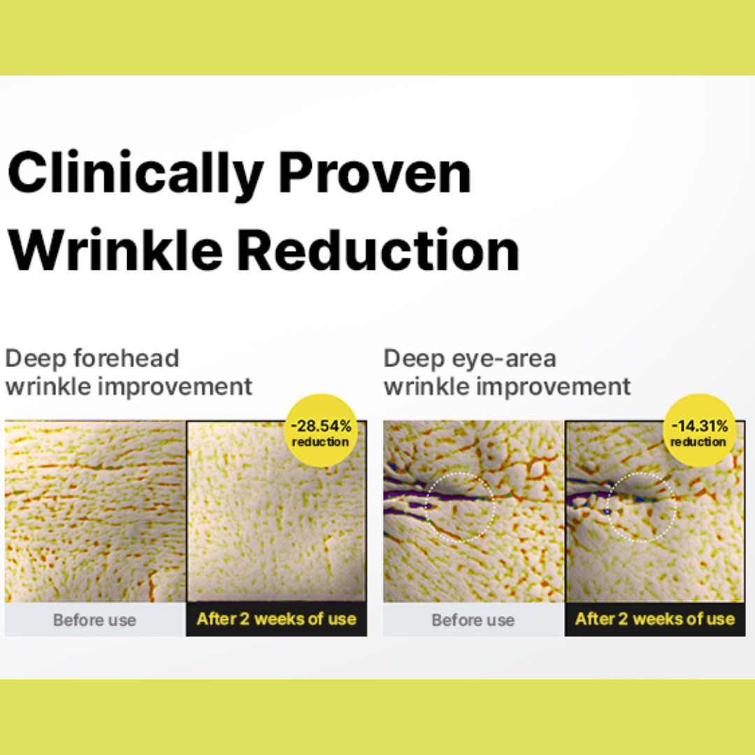Seoul 1988 Eye Cream +
Celimax Retinal Shot Booster